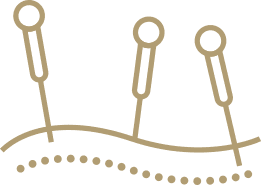 Acupuncture Clinic of Beauport-Limoilou