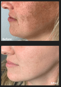ReNew Medical Laser & Skin Care Aesthetics Inc. gallery image 3