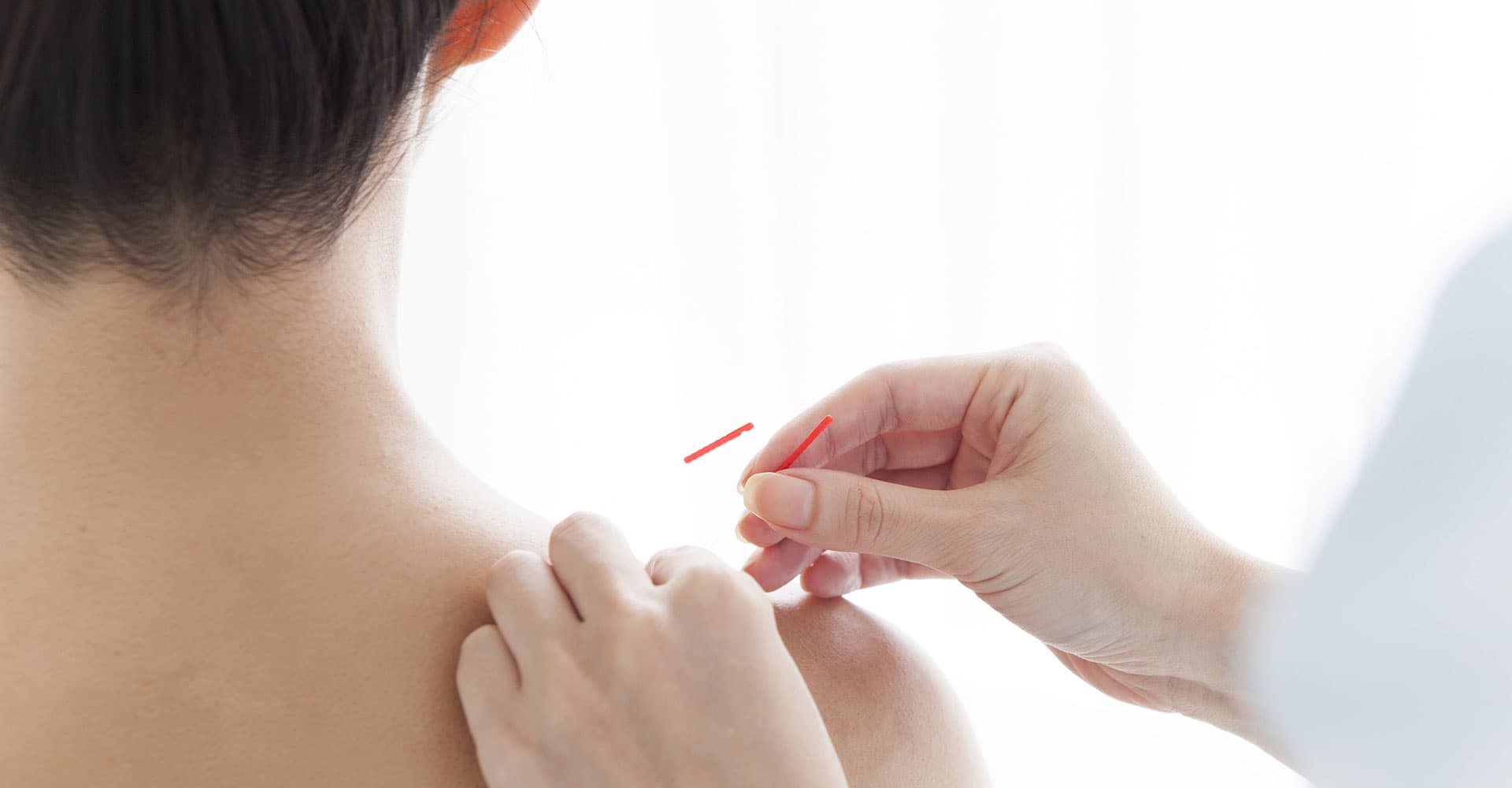 Acupuncture Chinoise Li Hui gallery image 3