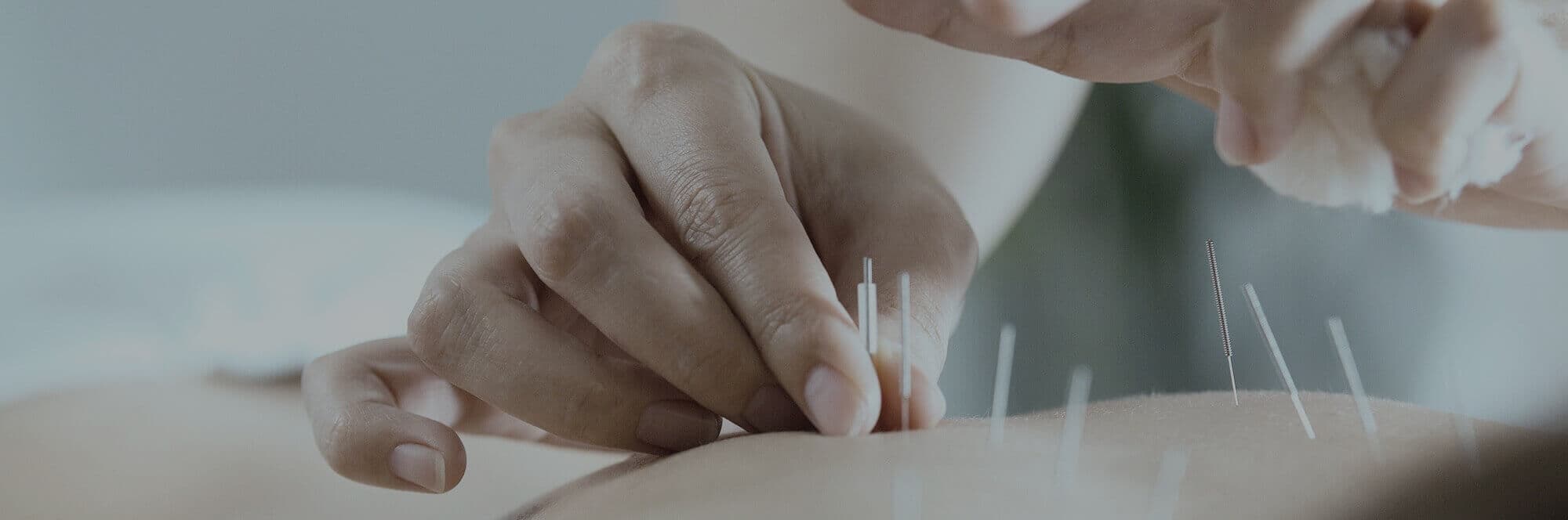 Acucure Acupuncture North Vancouver