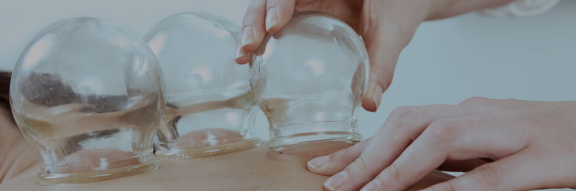 Acucure Acupuncture North Vancouver gallery image 2