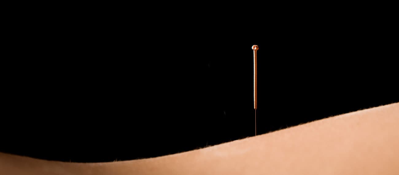 Clinique Chinoise d'Acupuncture gallery image 1