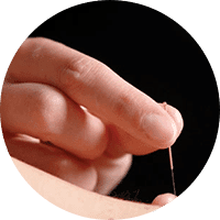 Acupuncture Maca gallery image 5