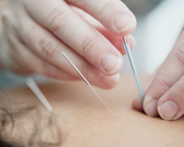 Nikki Acupuncture & Beauty Clinic gallery image 1