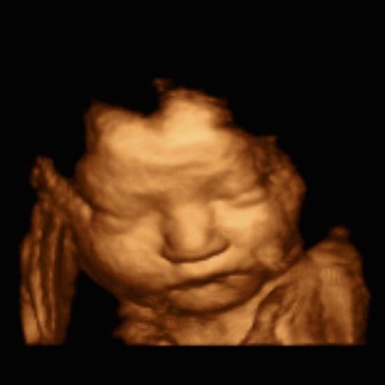 Mom2Bee 3D / 4D Pregnancy Ultrasound Halifax gallery image 3