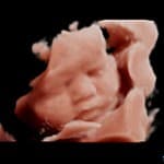 Mom2Bee 3D / 4D Pregnancy Ultrasound Halifax gallery image 2