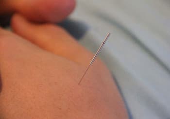 Sun's Acupuncture & Wellness Centre gallery image 4