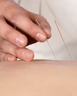 Parkland Rehab Physiotherapy gallery image 5