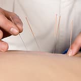 Peterborough Acupuncture gallery image 1