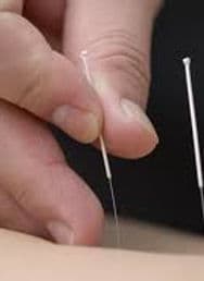 Balance Wellness Acupuncture gallery image 5