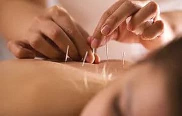 Mary's acupuncture and wellness centre gallery image 3