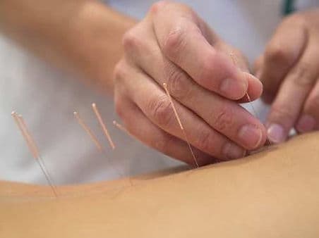 Clinique AcuMedicina gallery image 3